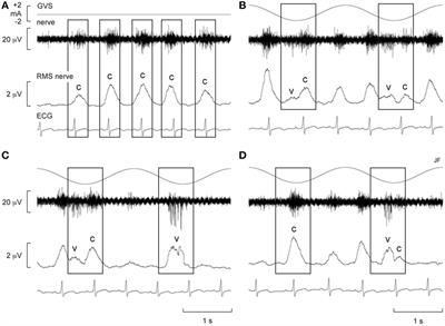 Vestibular Modulation of Sympathetic Nerve Activity to Muscle and Skin in Humans